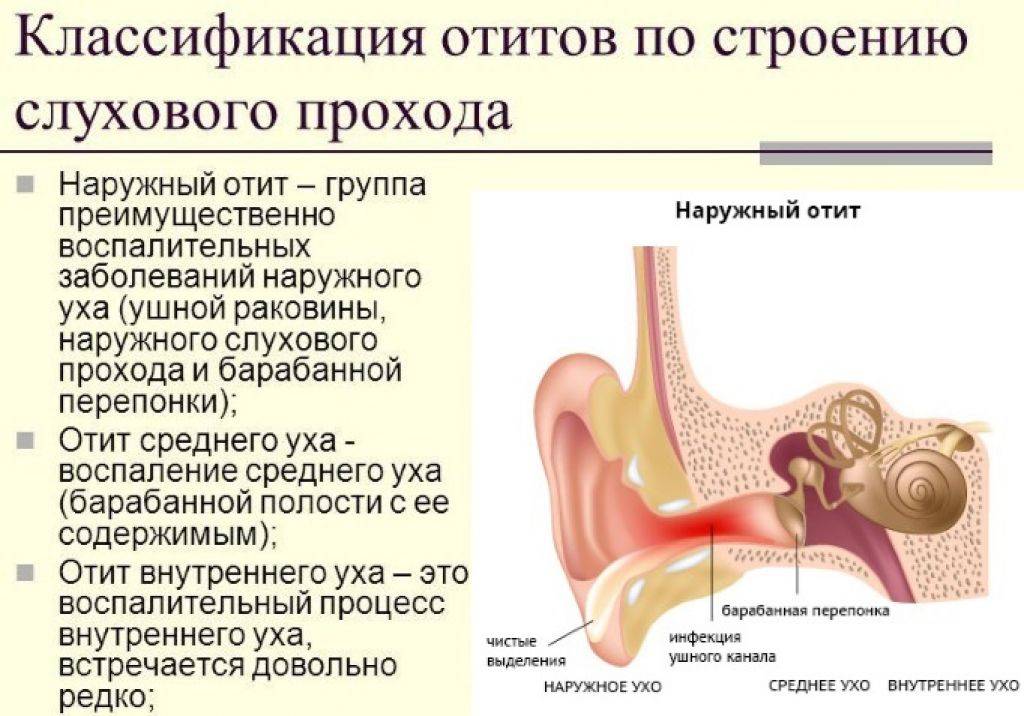 Острый тубоотит (евстахиит) у детей, причины, диагностика, лечение - лор клиника в чертаново