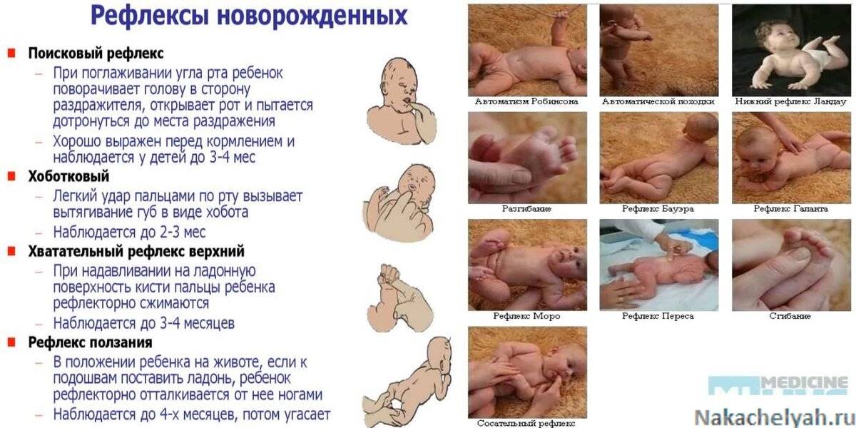 Безусловные рефлексы новорожденного