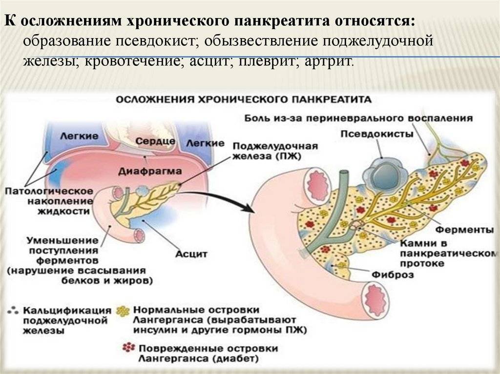 Панкреатит у детей: причины, признаки и особенности лечения