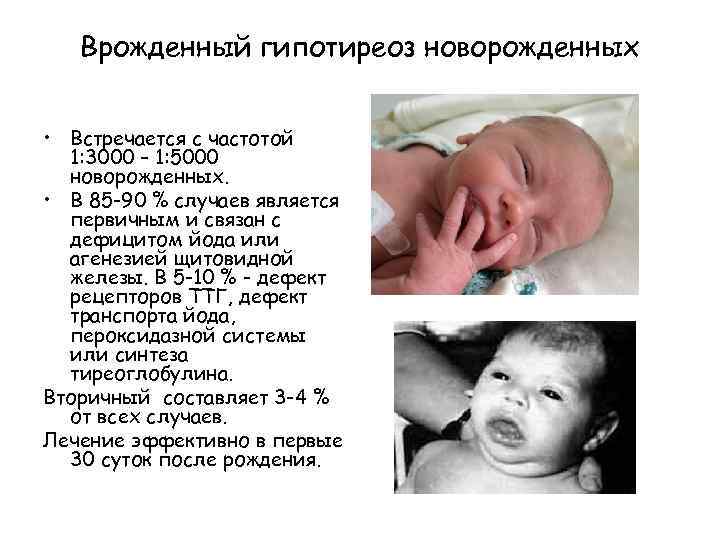 Стридор у новорожденных: признаки и причины возникновения патологии, диагностика заболевания у младенцев