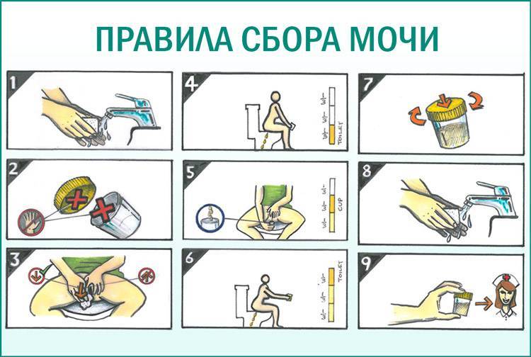 Анализы мочи при беременности: виды, норма и отклонение от нормы