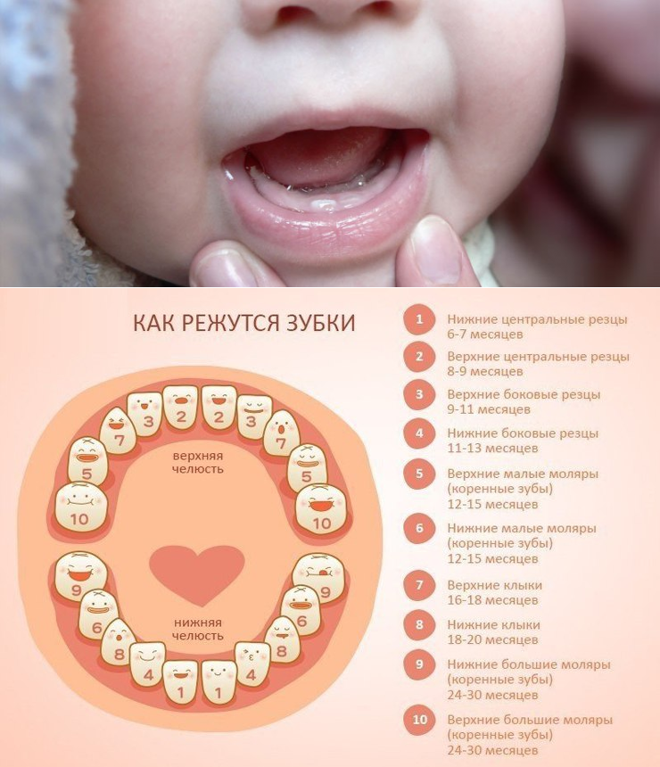 Симптомы прорезывания зубов у грудничков: что ждет родителей