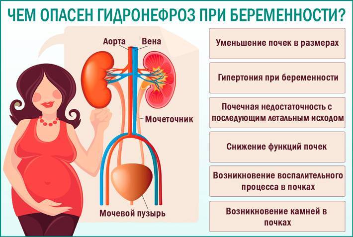 Фарингит при беременности: как лечить, влияние на плод | za-rozhdenie.ru