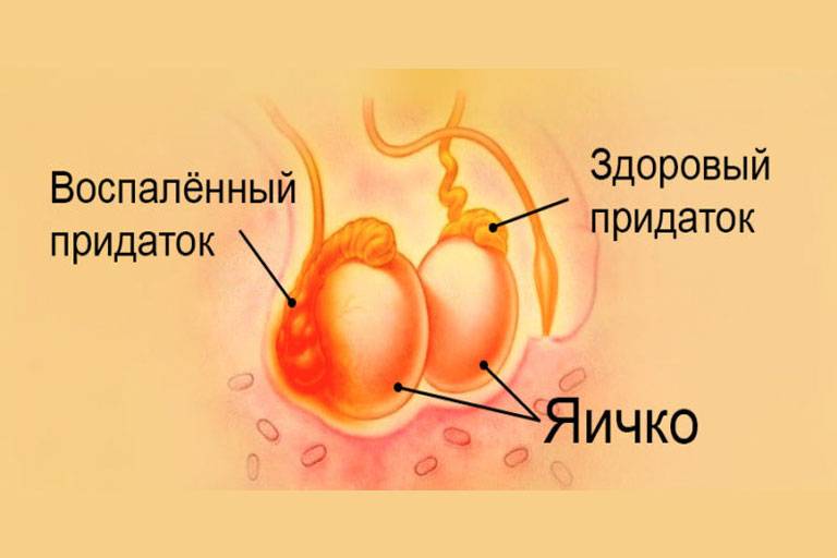Воспаление органов мошонки у мальчиков и мужчин