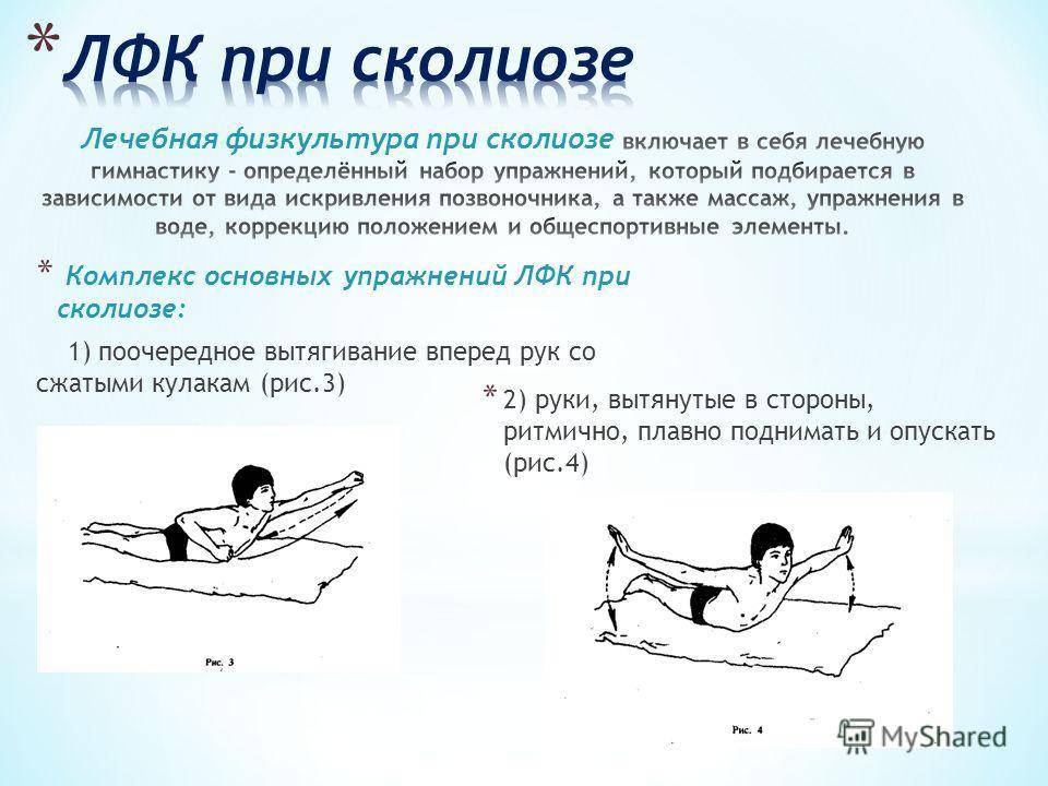 Упражнения от сколиоза для детей в домашних условиях: зарядка для позвоночника