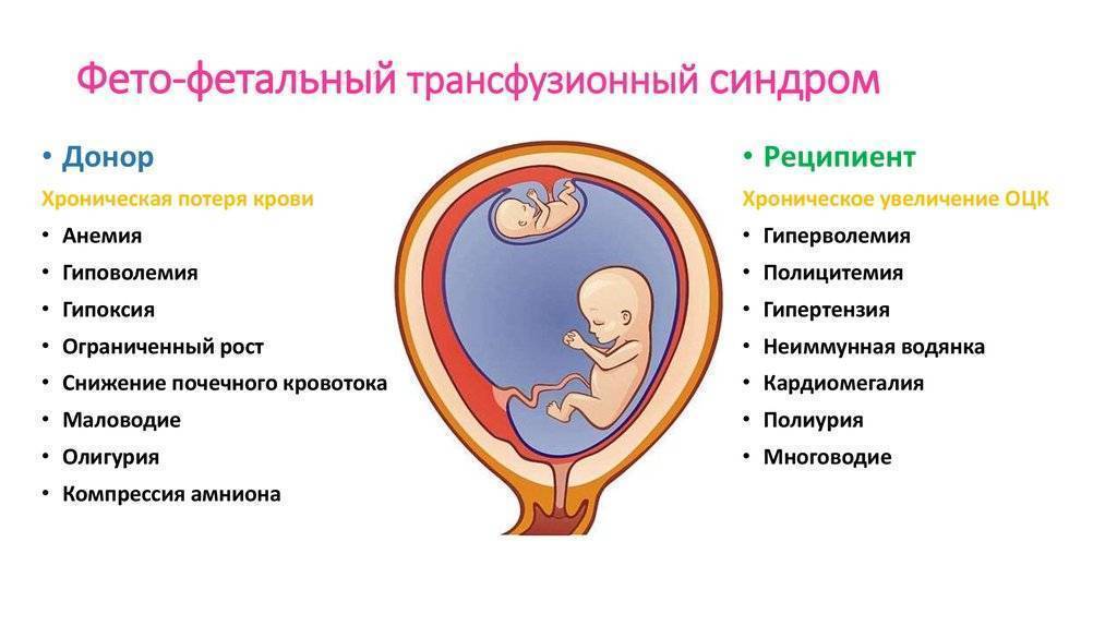 Двойня после процедуры эко: вероятность, особенности вынашивания близнецов, возможные риски и осложнения беременности
