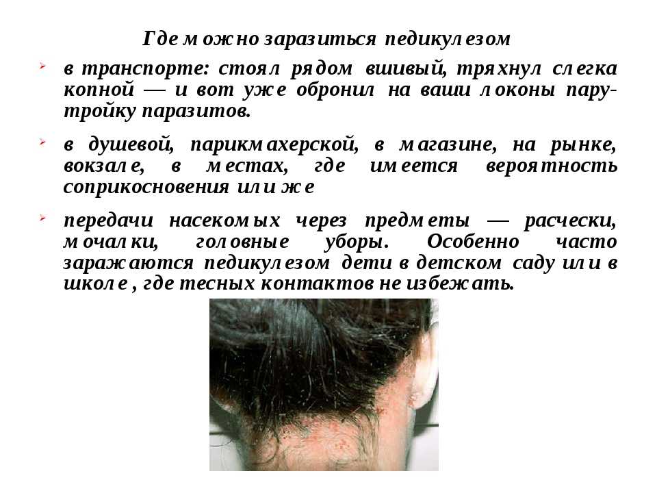 Почему у ребенка чешется чистая голова, если нет вшей: возможные причины и способы решения проблемы