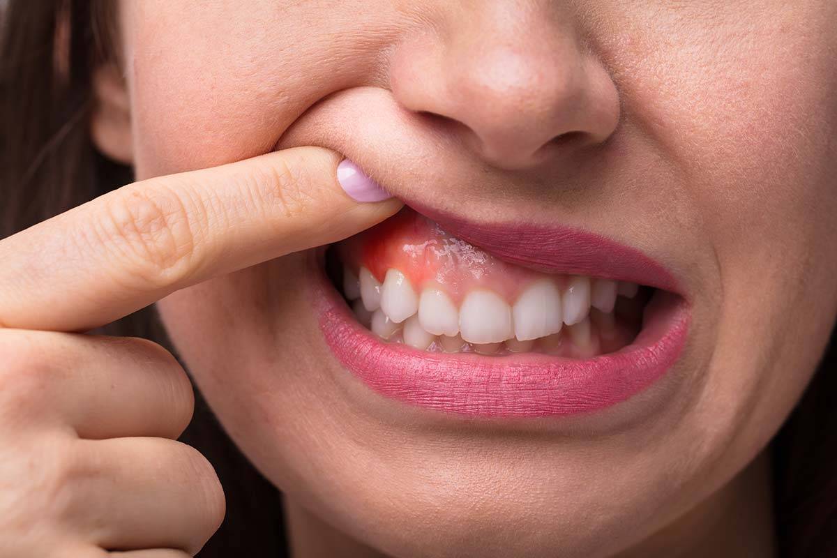 После удара почернел зуб у ребенка | стоматологический портал
