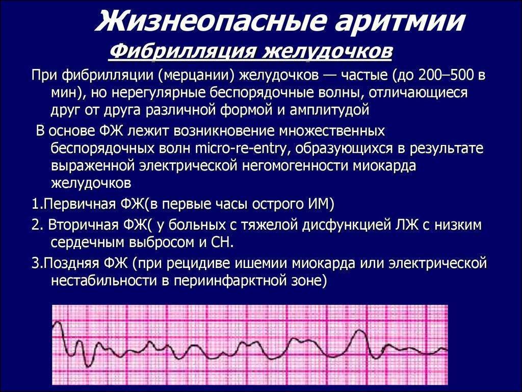 Синусовая аритмия у подростков