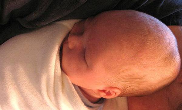 Гематома на голове у младенца: что делать и как обезопасить ребенка