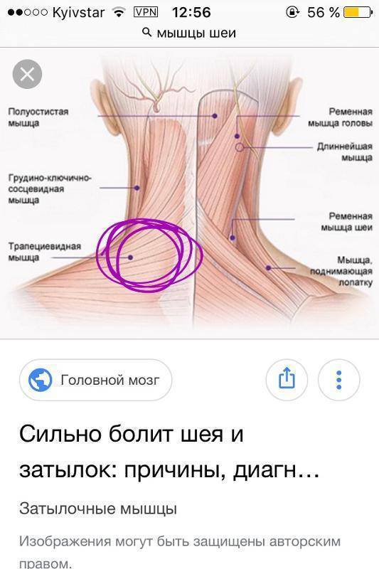 Боль в шее при наклоне и повороте головы: причины и лечение | ким
