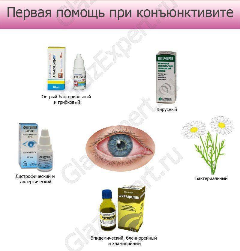Конъюнктивит у детей: симптомы и лечение в возрасте 2 лет
