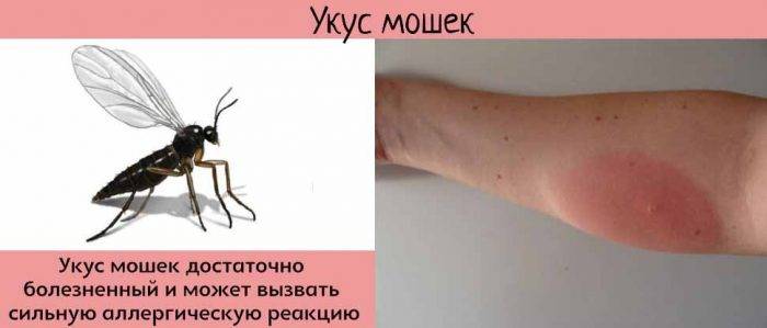 Что делать, если у ребенка после укуса комара опух глаз