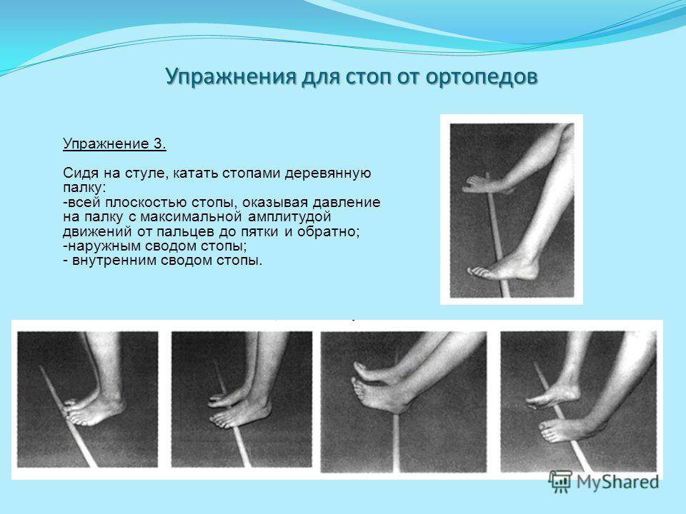 Вальгусная деформация коленных суставов у детей: лечение, признаки на фото, причины, последствия