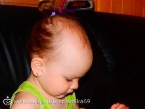 У ребенка плохо растут волосы на голове: что делать?