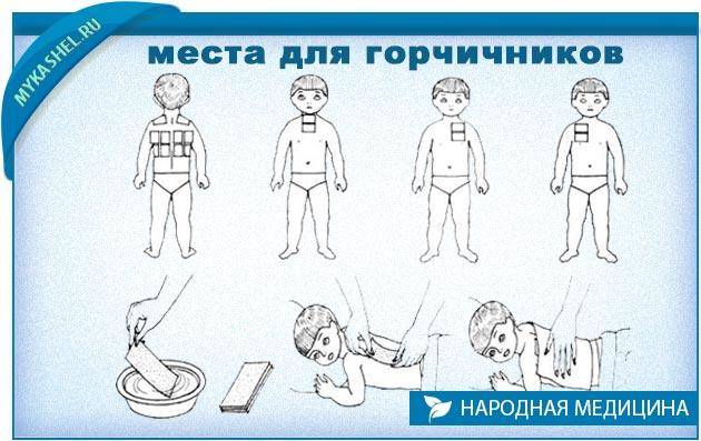 Как поставить горчичники ребенку: как правильно и со скольки лет можно, на сколько ставят | prof-medstail.ru