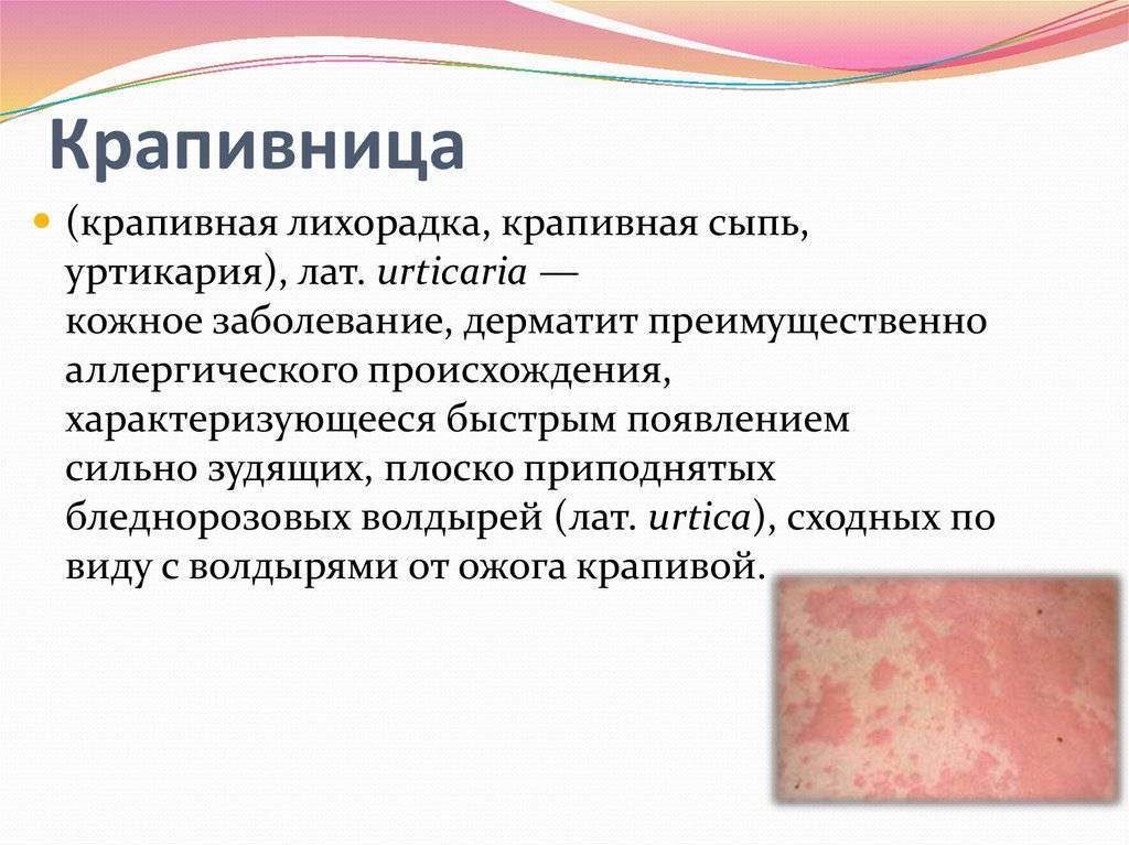 Контактный дерматит: фото у детей, виды и симптомы, лечение и профилактика