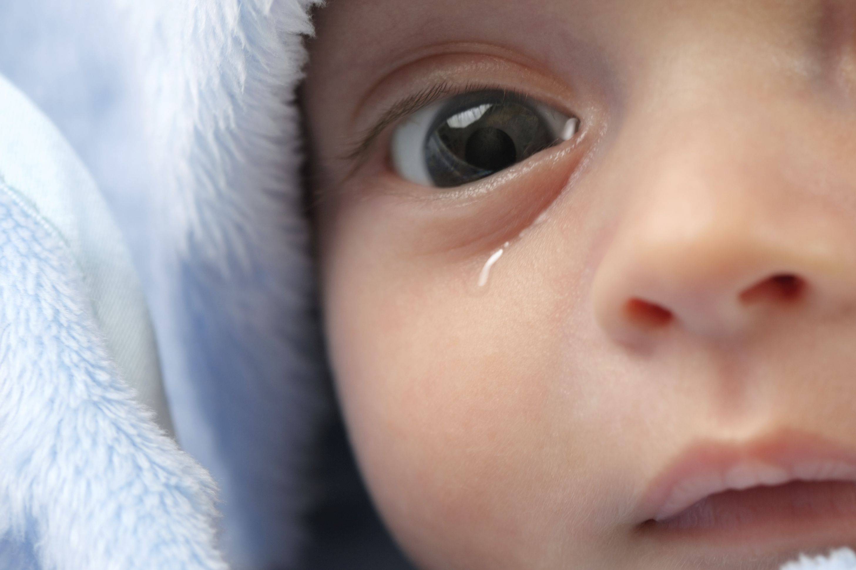 Закисание глаз, гнойные выделения у детей: симптомы, профилактика