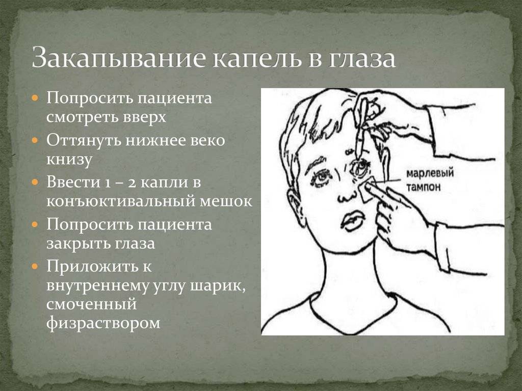 Техника закапывания капель в глаза, нос и ухо ребенку раннего возраста
