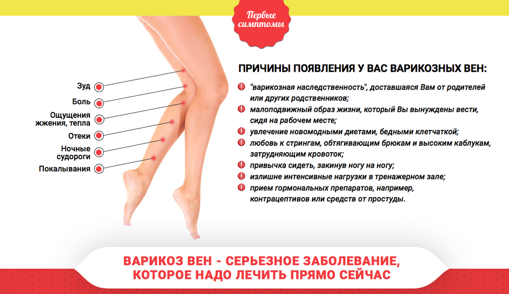 У ребенка болят ноги, жалуется по ночам - причины | prof-medstail.ru