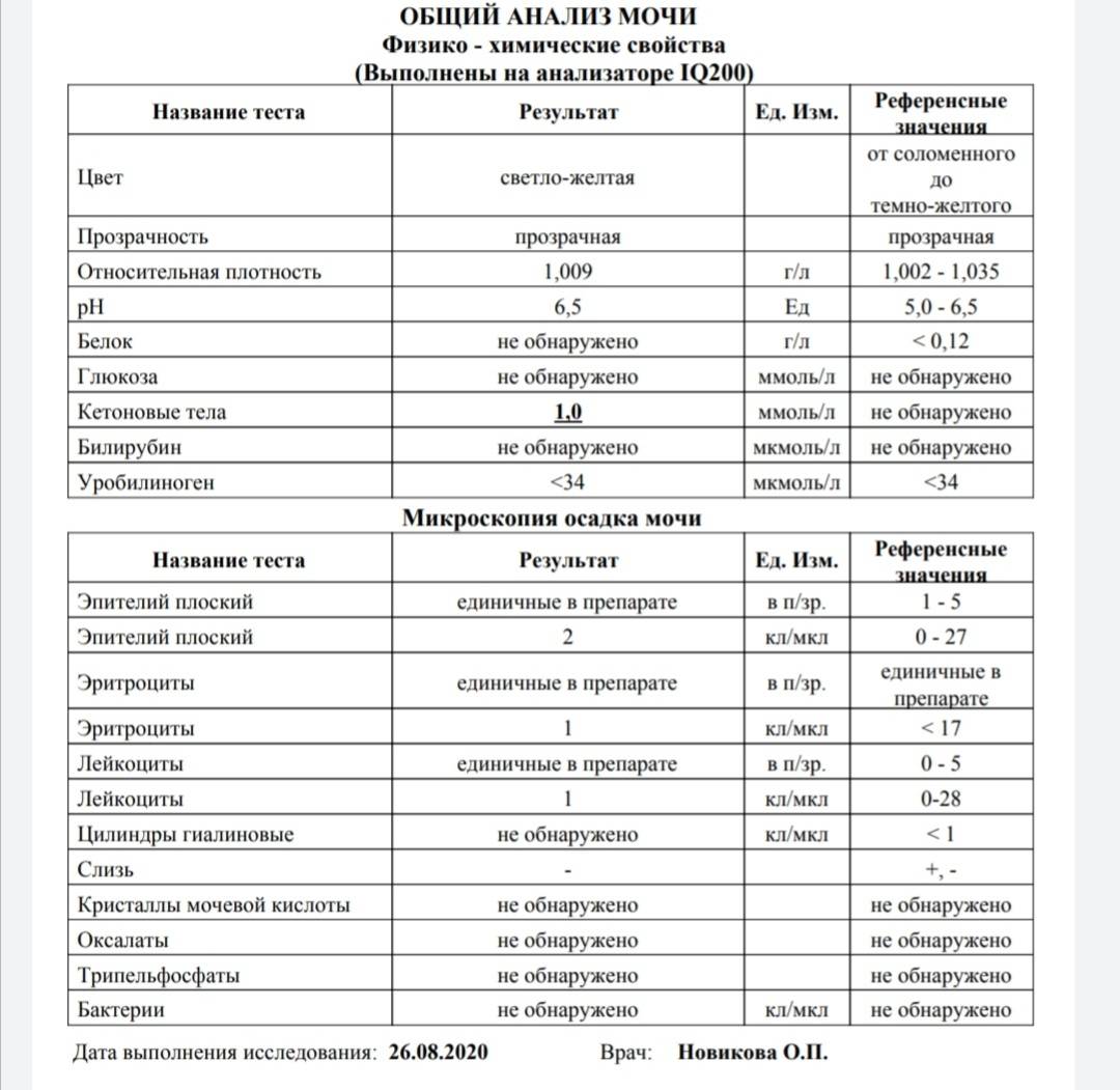 Расшифровка анализа мочи у маленьких детей