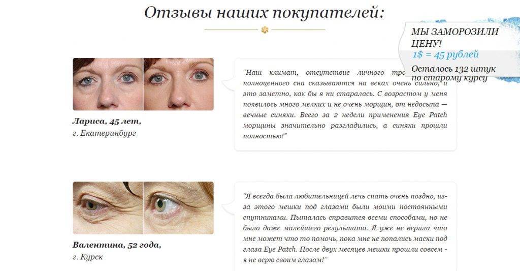 Мешки под глазами у ребенка