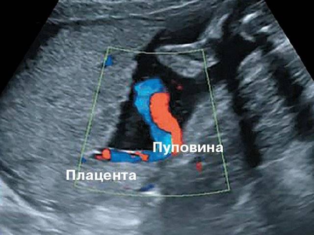 Развитие ребенка по неделям беременности — что происходит с эмбрионом