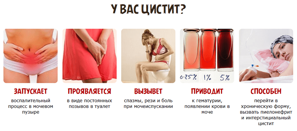 Признаки месячных: какие симптомы появляются перед менструацией, когда стоит бить тревогу?