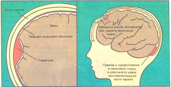 Что делать, если ребенок ударился головой и уснул