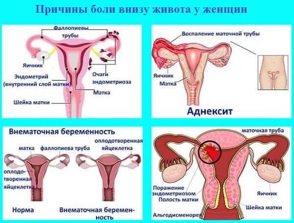Что делать, если при месячных сильно болит живот? * клиника диана в санкт-петербурге