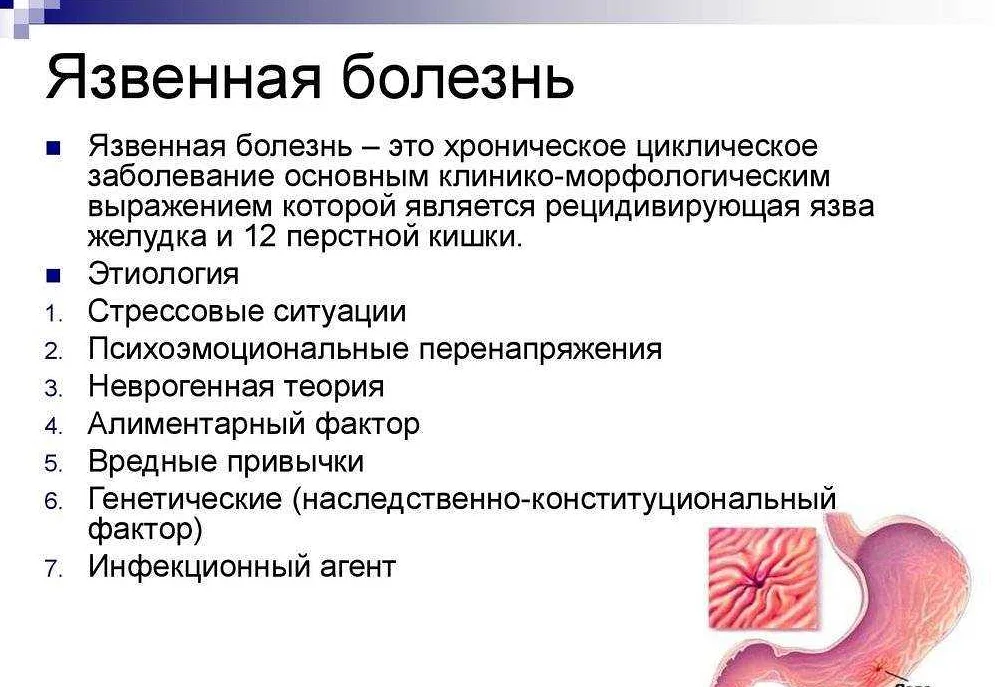 Язвенной болезни желудка презентация