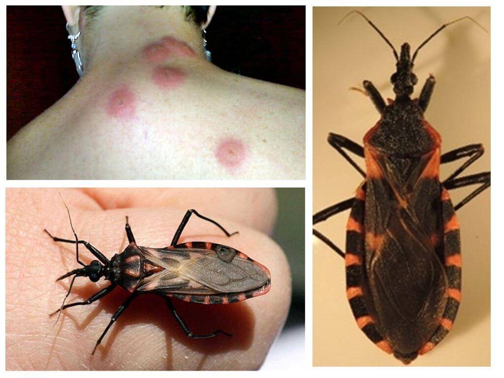 Определить кто кусается: клещи, клопы или блохи или неизвестных насекомых. фото укусов.