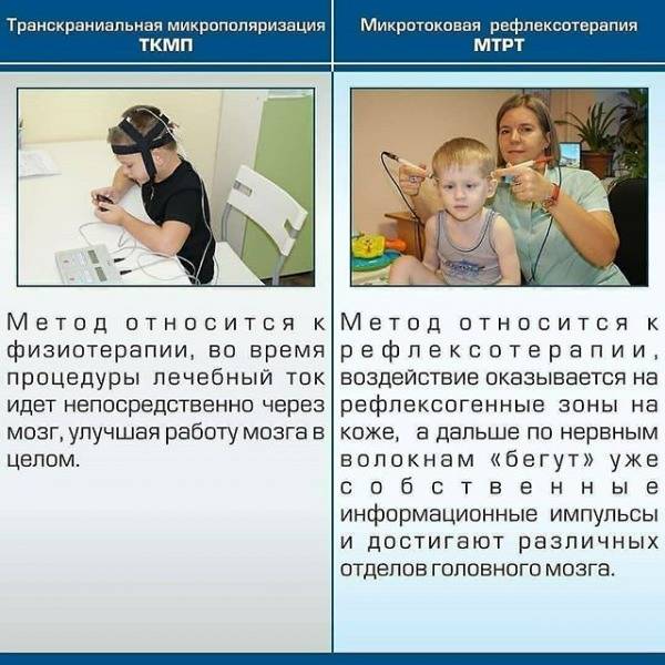 Транскраниальная микрополяризация