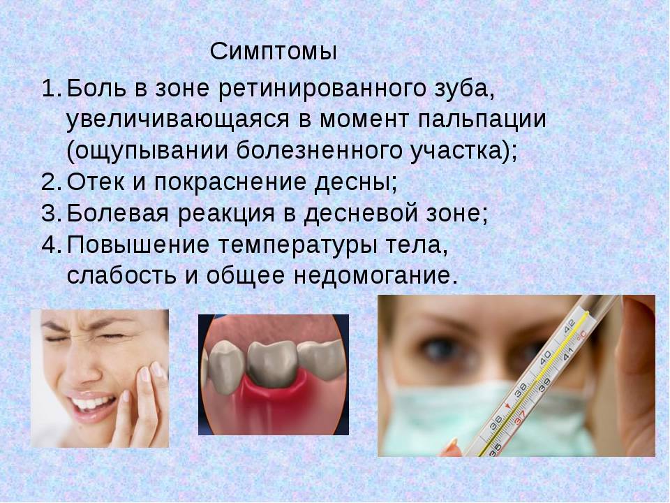 Молочные зубы – лечить или удалять?