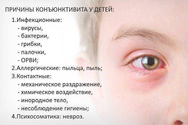 Конъюнктивит у детей до года: первые симптомы