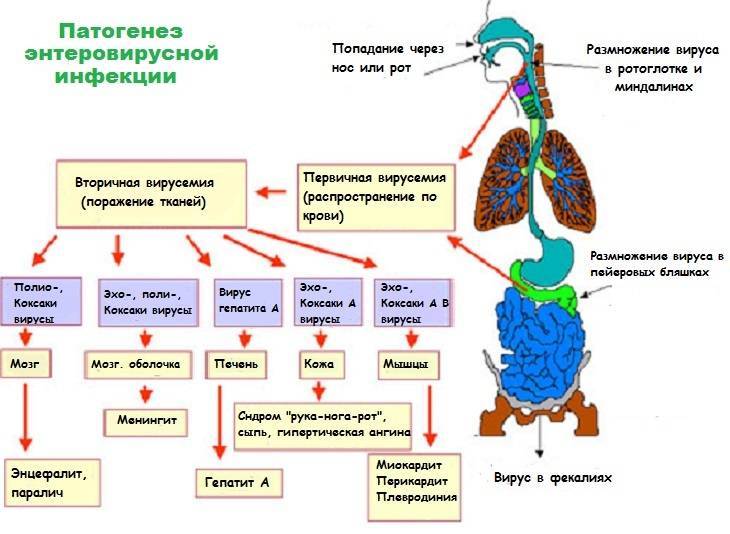 Энтеровирусный везикулярный стоматит синдром рука нога рот фото