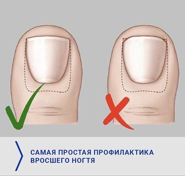 Как подстричь ногти  ребенку на руках и ногах? что делать если ребенок боится стричь ногти