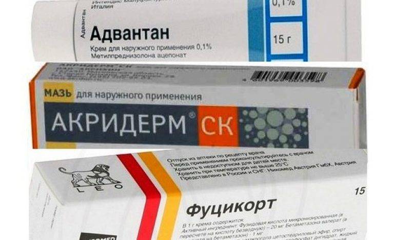 Мазь и крем от аллергии (атопическом дерматите) на коже для детей: виды, обзор лучших препаратов