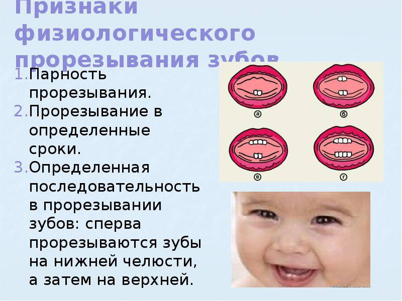 Рубрика Для Мама на Тему:"Прорезывание зубов у детей". Прорезывание молочных зуб