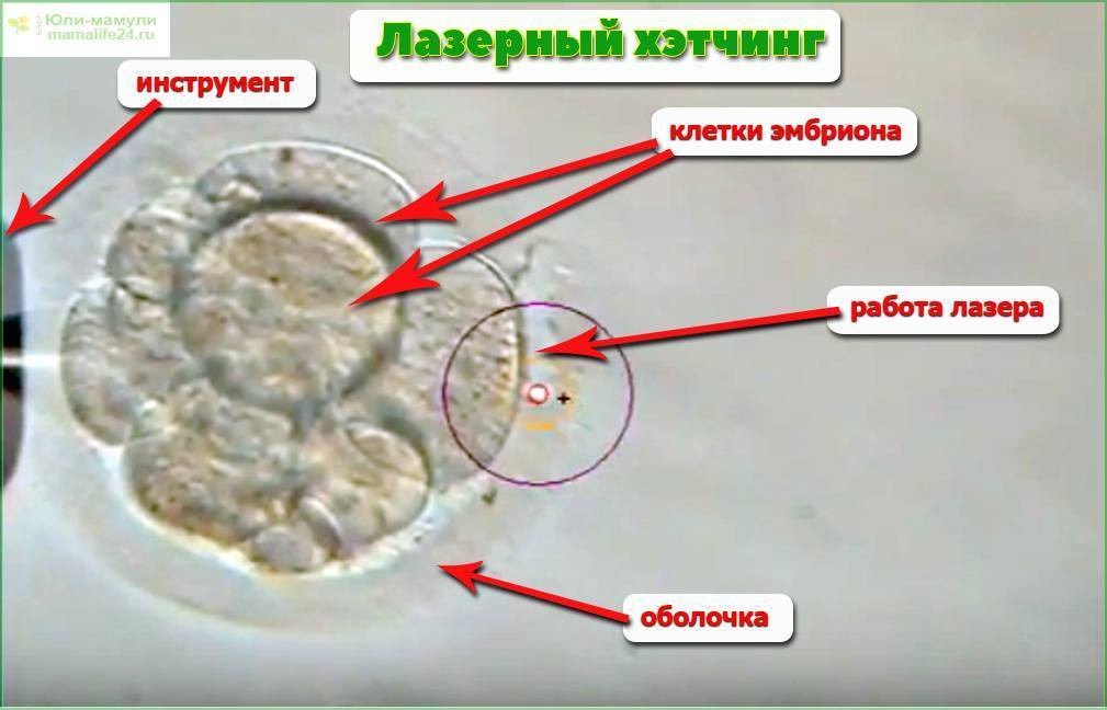 Эко: процедура от начала и до конца. этапы оплодотворения