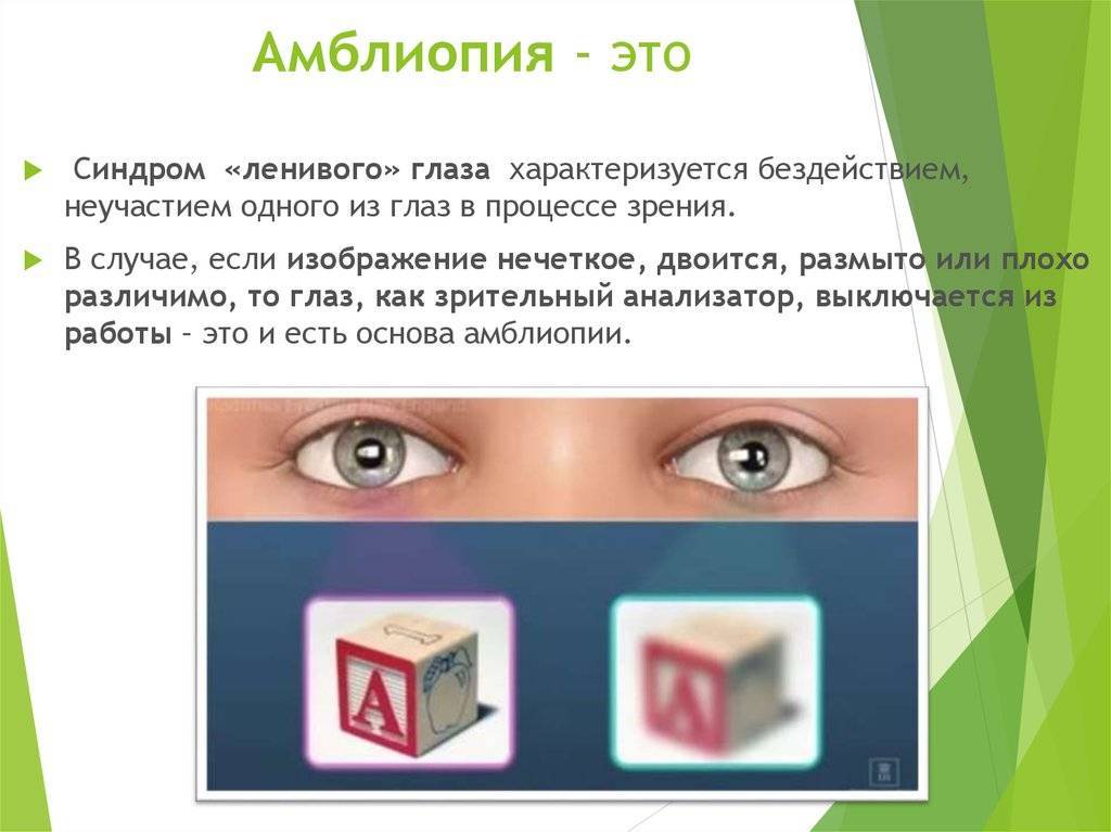 Амблиопия у детей - симптомы, причины, степени, лечение амблиопии