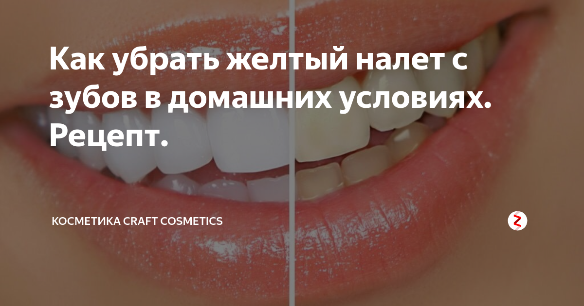 Черный налет на зубах у ребенка — почему образуется и как убрать налет пристли на молочных зубах у детей?