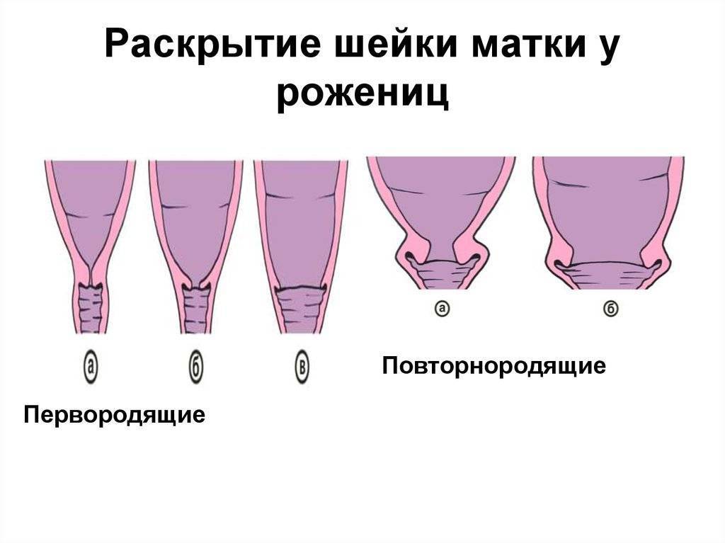 Рыхлая матка: что это значит и чем опасно?