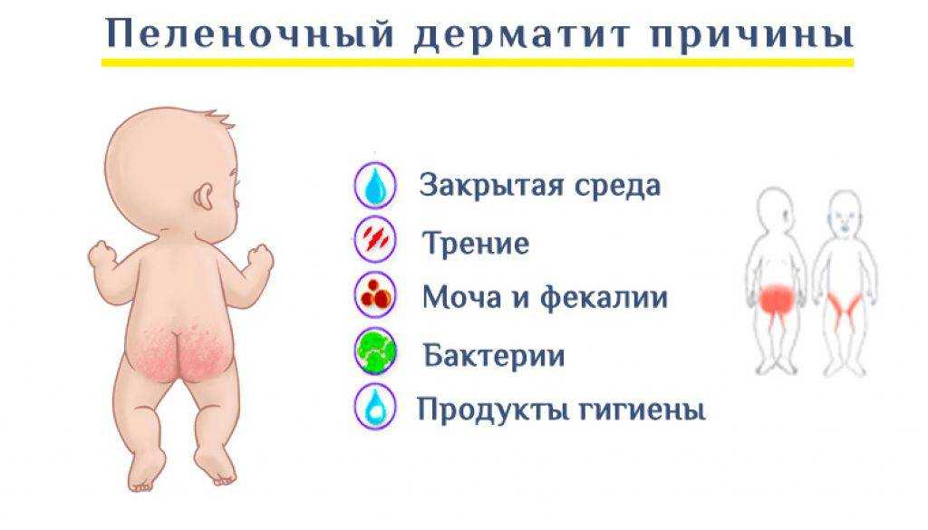 Красная попа у новорожденного | уроки для мам