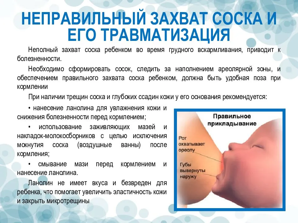 Впитывающие прокладки для грудного вскармливания: как выбрать подходящие