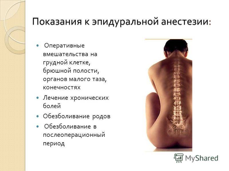 Почему болит спина после эпидуральной анестезии (эпидуралки)