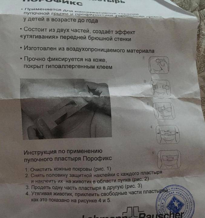 Как заклеить пупочную грыжу пластырем у новорожденного: пупочная грыжа у новорожденных: лечение пластырем — талантика — город профессий — главная