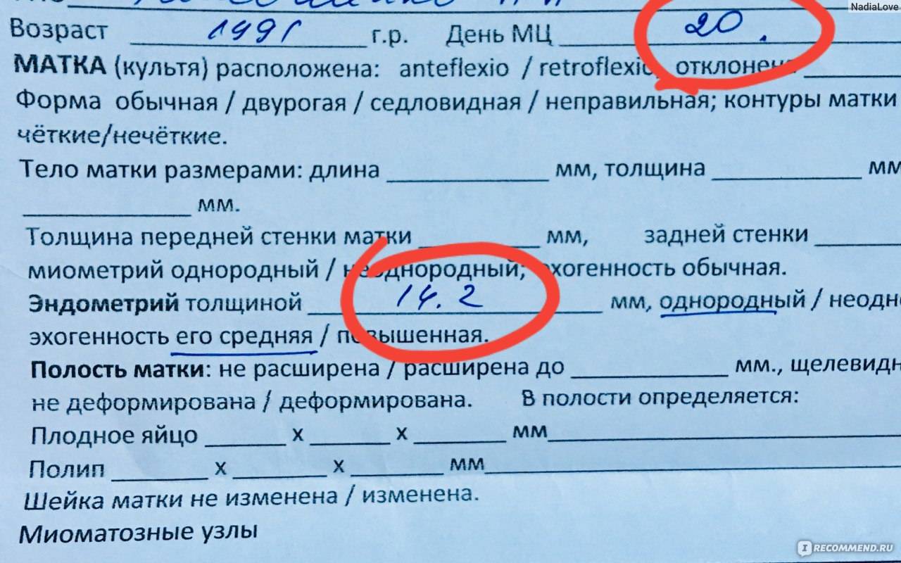 Отмена дивигеля при беременности после эко