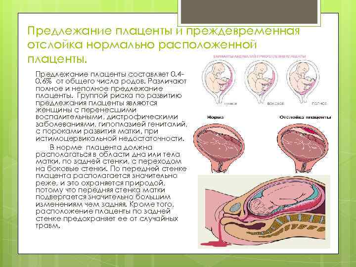 Нарушение маточно-плацентарного кровотока при беременности