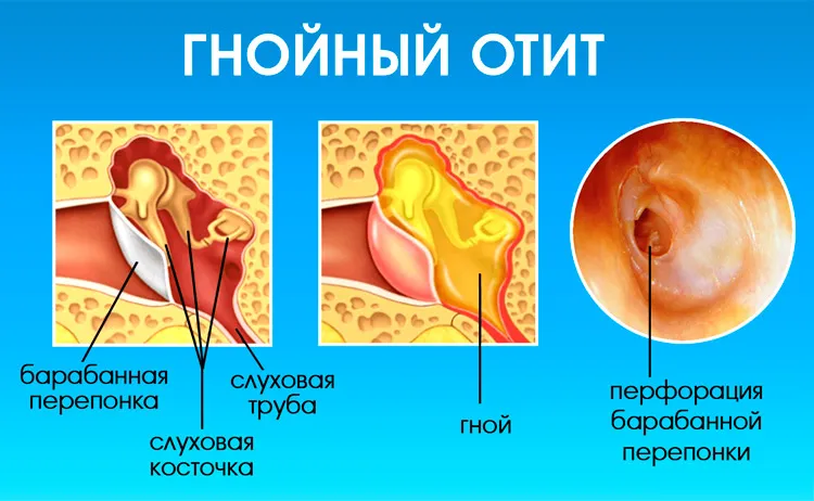 Тюльганская